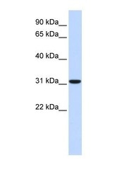 NBP1-54955 - Carbonic anhydrase 8